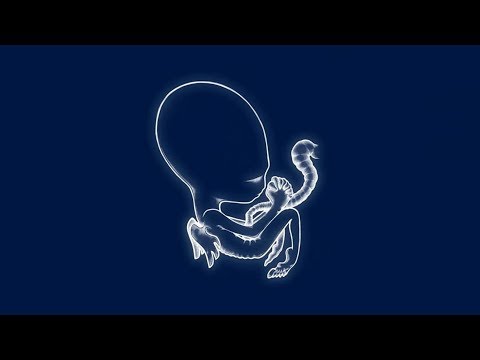 Sigur Rós - Svefn-g-englar