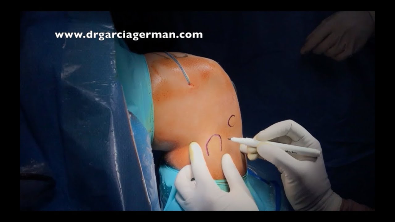 Diego García-Germán Vázquez-20