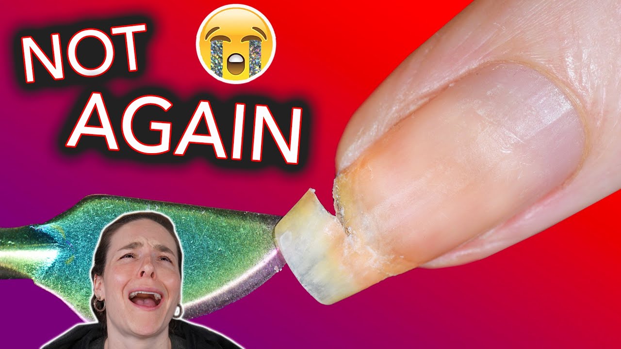 I Broke My Nail Again
