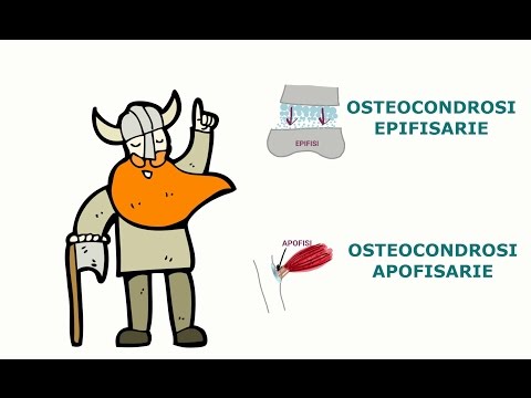 Giunti in gel Dikul comprare Fa male fortemente articolazioni delle gambe del piede che curare