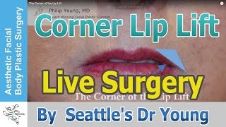 Dr. Philip Young