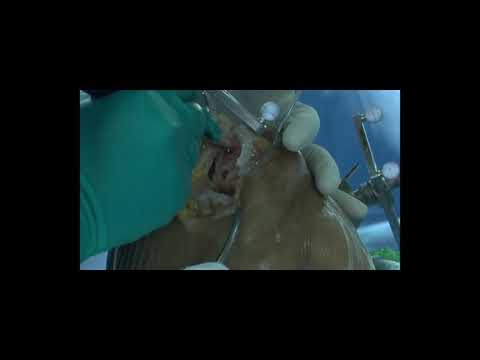 Introduction video