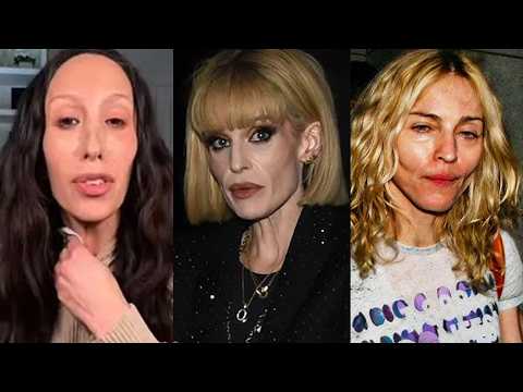 Fans Are Begging These Celebrities To Stop Using Ozempic | Then vs Now