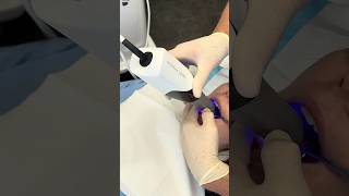 Download lagu Quick Dental Scan for Retainer Fitting mp3 Download lagu Quick Dental Scan for Retainer Fitting mp3
