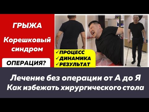 Грыжа с корешковым синдромом, из-за которой перекосило туловище