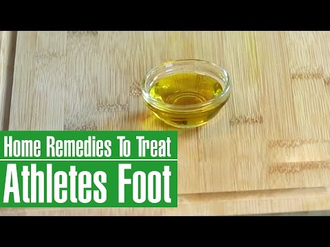 3 Best Home Remedies To TREAT ATHLETE'S FOOT (ITCHING, SCALING & REDNESS)