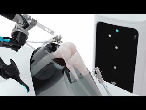 VELYS Robotic Surgery by Dr. Amit Jaiswal