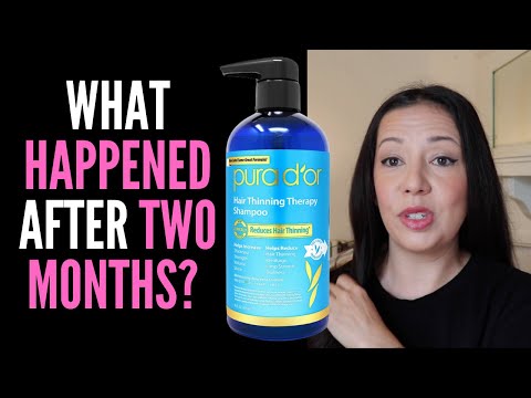 HAIR LOSS SUFFERER TESTS PURA D'OR ANTI THINNING...