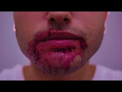 Valuá, Potyguara Bardo - Veneno