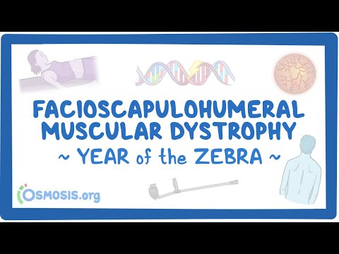 Achalasia Year of the Zebra