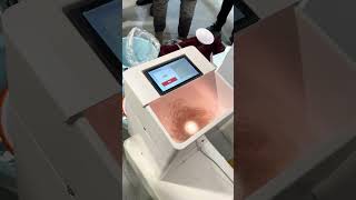 ASÍ SE CUENTAN MILES DE ALEVINES EN SEGUNDOS