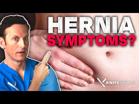 Hernia Symptoms - When should you WORRY?