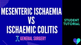 Mesenteric Ischaemia vs Ischaemic Colitis - Medical Tutorial