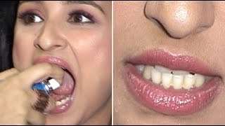 Parineeti Chopra Shows Off Her Dirty Yellow Teeth!