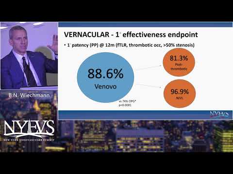 The Venovo Stent   Bret N  Wiechmann  Venous Symposium