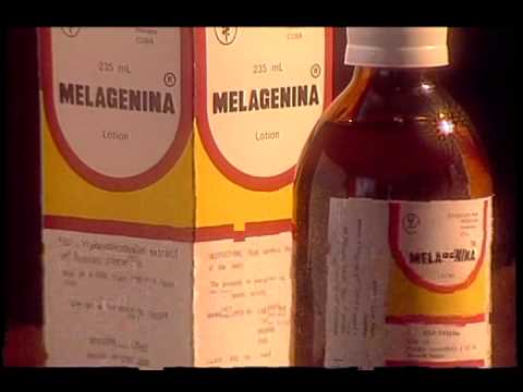 Rosso con lentiggini e occhi verdi Laskorutin da pigmentary nota lapplicazione