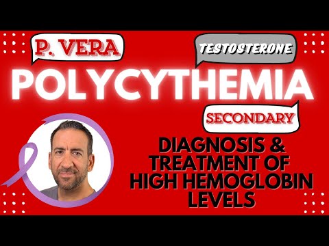 Polycythemia: Diagnosis & Treatment of Elevated Hemoglobin Level