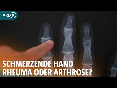 Rheuma und Arthrose: Das hilft bei Schmerzen in den Händen I ARD Gesund