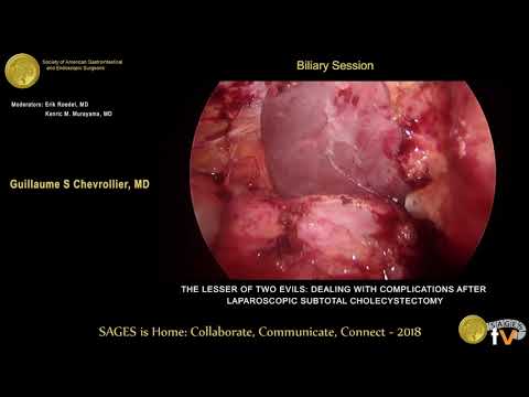 The lesser of two evils: Dealing with complications after laparoscopic subtotal cholecystectomy from the SAGES Video Library