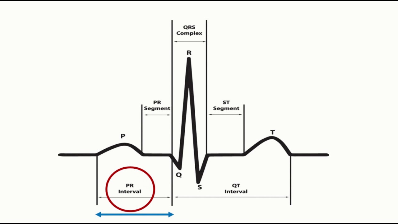 Corrected QT interval (QTc) calculation with Bazett's formula