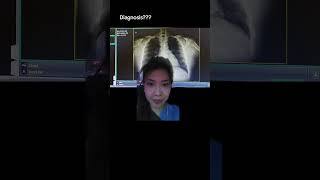 Diagnosis Unremarkable chest findings