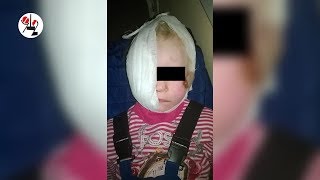 Неужели, та?! Мелькнула собака, покусавшая девочку