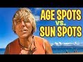 AGE SPOTS or SUN SPOTS on Skin? How to Get Rid of Them?