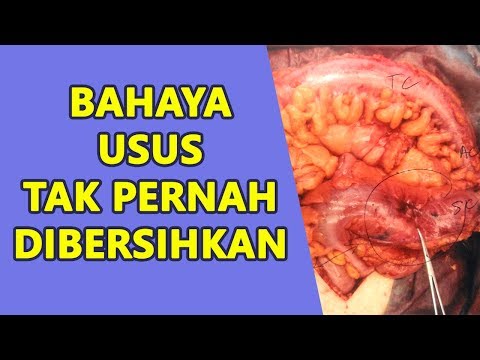 Menonton transmisi secara online harus berbicara tentang penurunan berat badan Penurunan berat badan dengan ulasan tepung rami
