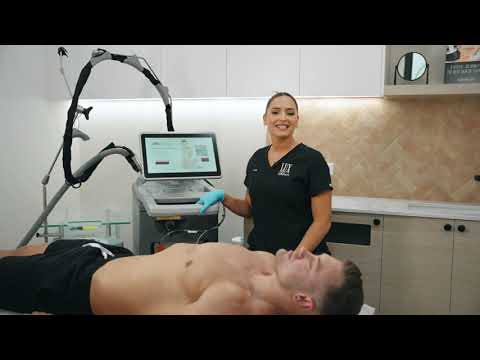 Deka Laser Machine Showcase