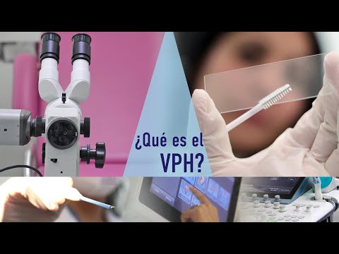 ¿Qué es el VPH?