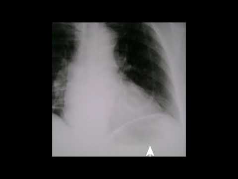 15. deadrazy - pasaisviesisз marts no kadaફ [29.09.2018]