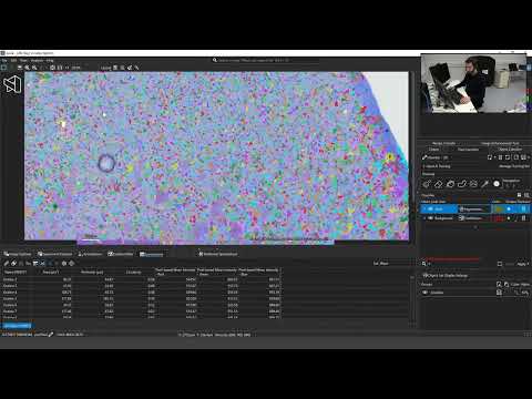 Laser Microdissection for Spatial Proteomics