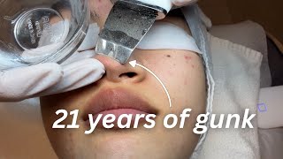 I Got the Most Disgusting Facial in Korea