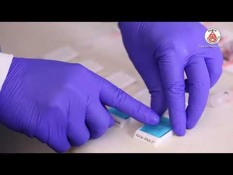 04 Simultaneous processing of multiple  specimens  for making cell blocks with Micro- NGCB units