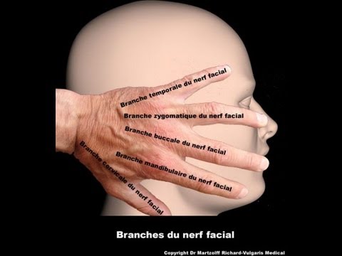 comment soulager nevralgie facial