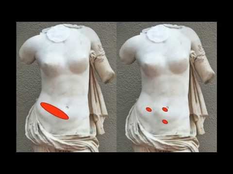 TED】ニコライ・ベッグ。手術で最も危険な瞬間の一つを治す道具 (Nikolai Begg: A tool to fix one of the most dangerous moments in surgery) (【TED】Nikolai Begg: A tool to fix one of the most dangerous moments in surgery (Nikolai Begg: A tool to fix one of the most dangerous moments in sur