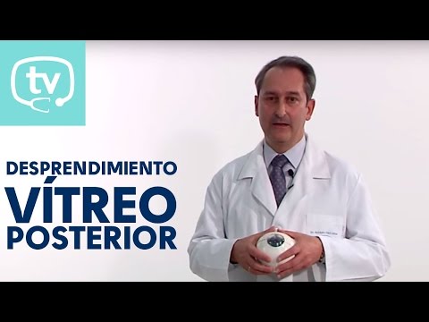 Desprendimiento del vítreo posterior