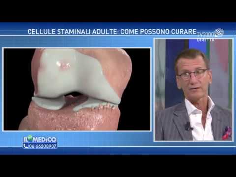 Anchilosi dellarticolazione del ginocchio Malattia comune e il mare