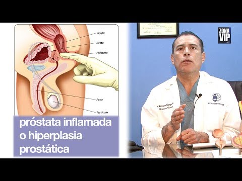 Toxoplazmózis prosztatitis