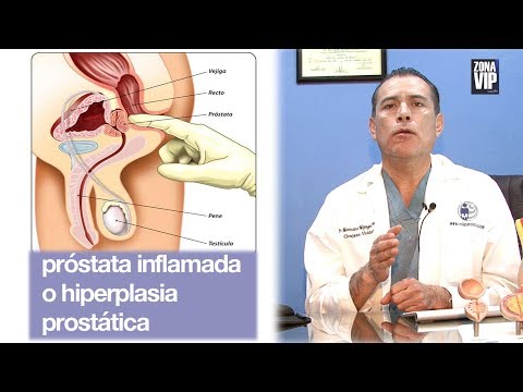 Genitális herpesz és prostatitis