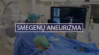 Smegenų aneurizma - bomba ir nuosprendis? Šiais laikais yra išeitis, tik nelaukite griaustinio.