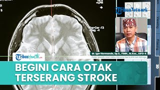 Begini Proses Stroke di Otak: Dari Awal hingga Kerusakan Saraf