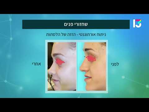 ניתוחים לשחזור הפנים: הכירו את האפשרויות הקיימות