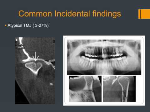 Carestream Dental: CBCT in Orthodontics