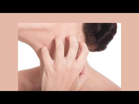Vario cibo a psoriasi In che differenza di atopic e dermatite allergica