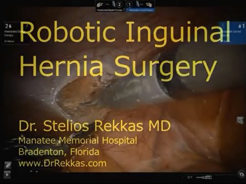 Robotic Inguinal Hernia