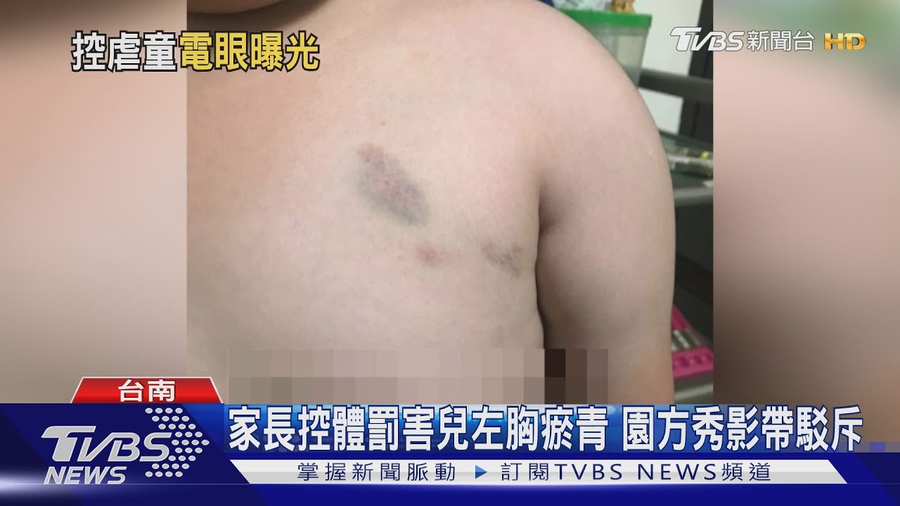 家長控體罰害兒左胸瘀青　園方秀影帶駁斥