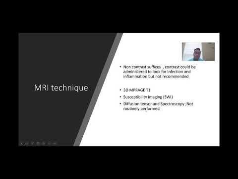 Interational Webinars - Imaging in Movement Disorders - Dr Siddartha G - University of Alabama,