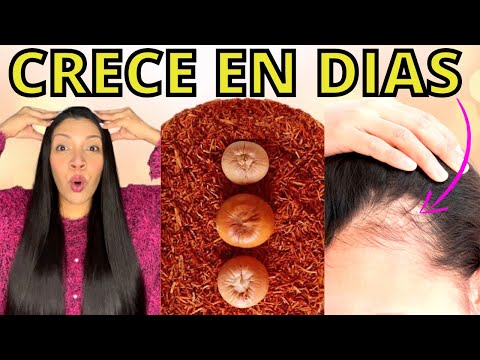 , title : 'EL CABELLO CRECE COMO LOCO Y NO SE CAE😱 LA MEJOR RECETA DEL MUNDO PARA CRECER CABELLO😍'