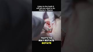 Listen to the tooth it will tell you what to do! Tooth extractions 101! #toothextractions